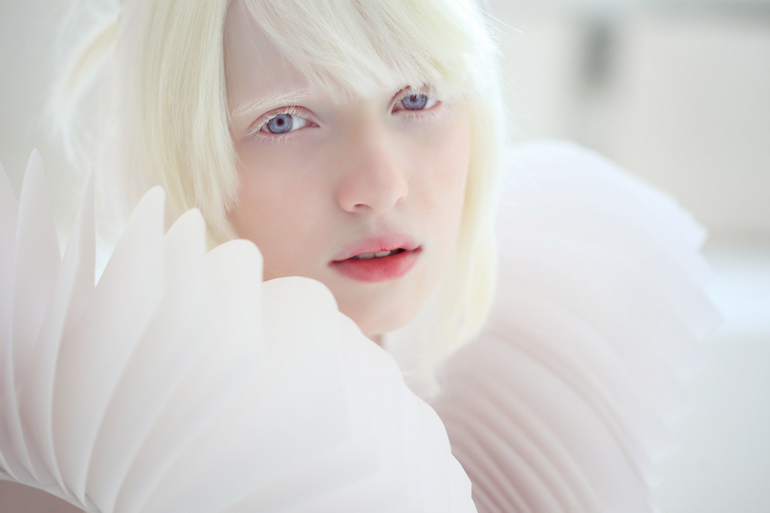 альбинос
