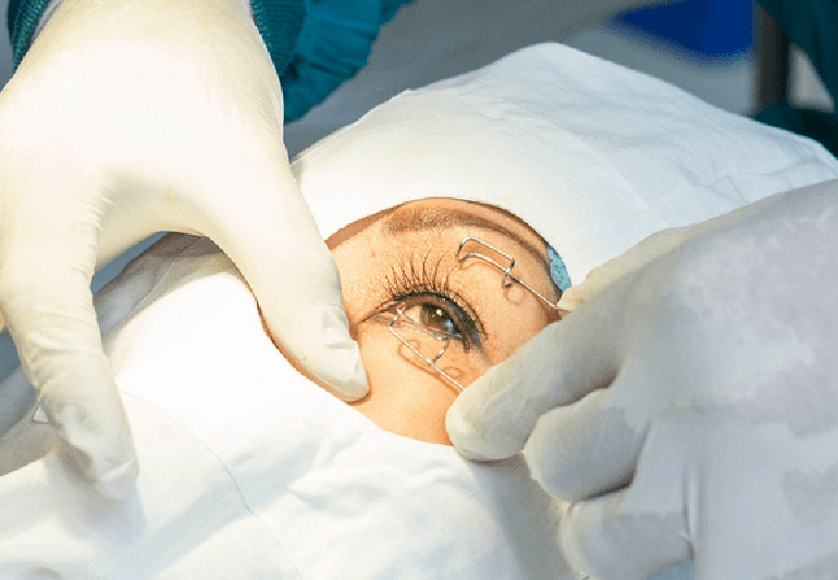 расширитель для глаза для проведения операции