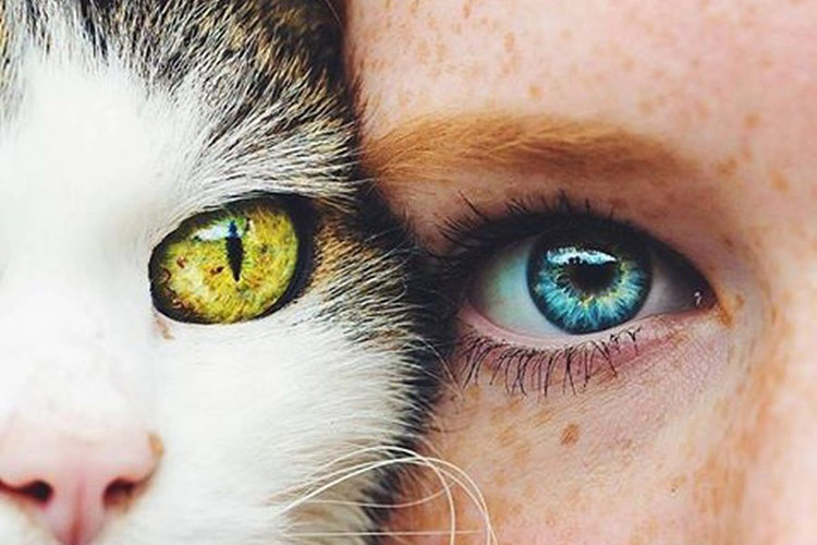 Что такое синдром кошачьего глаза и можно ли его вылечить?