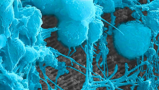 Nanoimplantant-vosstanovlenie-zrenija